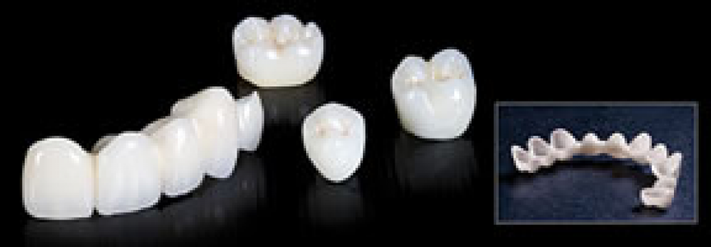 Coroane zirconiu dentare de la Sporting International Dental