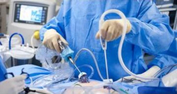 Operatii laparoscopice